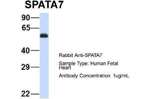 Host: Rabbit  Target Name: SPATA7  Sample Tissue: Human Fetal Heart  Antibody Dilution: 1. (SPATA7 antibody  (Middle Region))