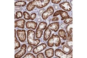 Immunohistochemical staining of human kidney with DNAJC16 polyclonal antibody  shows strong cytoplasmic positivity in cells in tubules at 1:50-1:200 dilution. (DNAJC16 antibody)