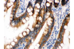 Immunohistochemistry (Paraffin-embedded Sections) (IHC (p)) image for anti-UPF1 Regulator of Nonsense Transcripts Homolog (UPF1) (AA 578-614), (Middle Region) antibody (ABIN3043955) (RENT1/UPF1 antibody  (Middle Region))