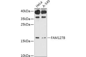 Western blot analysis of extracts of various cell lines, using FB antibody (ABIN7267107) at 1:1000 dilution. (FAM127B antibody  (AA 1-113))