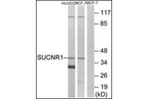 Western blot analysis of extracts from HuvEc/MCF-7 cells, using SUCNR1 Antibody. (SUCNR1 antibody)