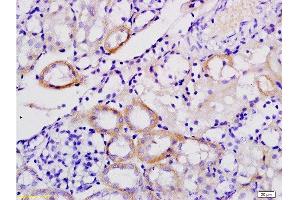 Formalin-fixed and paraffin embedded mouse kidney tissue labeled with Anti-Galectin-9 Polyclonal Antibody , Unconjugated at 1:200, followed by conjugation to the secondary antibody and DAB staining (Galectin 9 antibody  (AA 101-180))