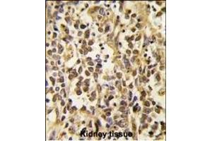 Formalin-fixed and paraffin-embedded human kidney tissue reacted with the primary antibody, which was peroxidase-conjugated to the secondary antibody, followed by DAB staining. (DNMT3A antibody  (AA 457-486))