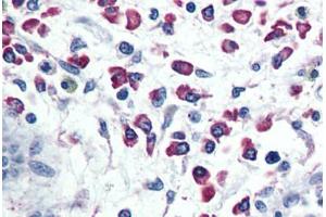 Anti-CXCR1 antibody  ABIN1048470 IHC staining of human colon, plasma cells. (CXCR1 antibody  (Internal Region))