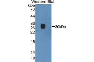 Detection of Recombinant TANK, Human using Polyclonal Antibody to TRAF Family Member Associated NFKB Activator (TANK) (TANK antibody  (AA 131-369))