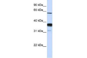 SMPD3 antibody used at 1 ug/ml to detect target protein.