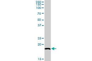 SNX12 MaxPab rabbit polyclonal antibody. (SNX12 antibody  (AA 1-172))