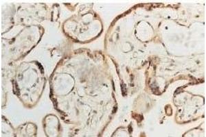 Immunohistochemistry analysis using Rabbit Anti-SOD1 Polyclonal Antibody (ABIN361645 and ABIN361646).