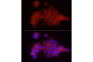 Immunofluorescence analysis of MCF7 cells using VEGFR3/FLT4 Rabbit pAb (ABIN6130779, ABIN6140698, ABIN6140701 and ABIN6217251) at dilution of 1:100 (40x lens). (FLT4 antibody  (AA 1174-1363))