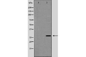 Western blot analysis of AQP5 expression in HUVEC cells,The lane on the left is treated with the antigen-specific peptide. (Aquaporin 5 antibody  (C-Term))