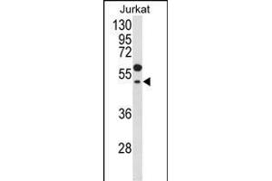 Western blot analysis of GNAT1 Antibody (C-term) (ABIN653740 and ABIN2843042) in Jurkat cell line lysates (35 μg/lane). (GNAT1 antibody  (C-Term))