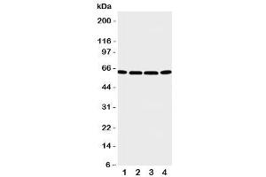 Western blot testing of P2X6 antibody and Lane 1:  U87 (P2RX6 antibody  (C-Term))