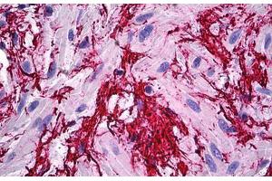 Human Prostate, Extra Cellular Matrix: Formalin-Fixed, Paraffin-Embedded (FFPE) (Fibrillin 1 antibody  (AA 45-450))
