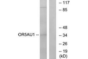 Western blot analysis of extracts from Jurkat cells, using OR5AU1 Antibody. (OR5AU1 antibody  (AA 201-250))
