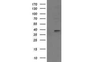 Image no. 1 for anti-Mitogen-Activated Protein Kinase Kinase 3 (MAP2K3) antibody (ABIN1499414) (MAP2K3 antibody)