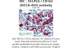 Image no. 1 for anti-Selectin P Ligand (SELPLG) antibody (ABIN5693705) (SELPLG antibody)