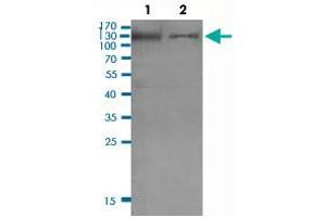 Western Blot (Cell lysate) analysis of (1) KB cell lysate and (2) PC-3 cell lysate.