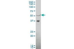 MGC15730 polyclonal antibody (A01), Lot # 051205JC01. (IGSF21 antibody  (AA 201-300))