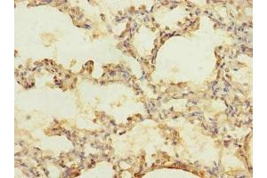 Immunohistochemistry of paraffin-embedded human lung tissue using ABIN7175581 at dilution of 1:100 (CACNA2D2 antibody  (AA 20-200))