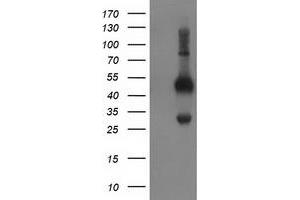 HEK293T cells were transfected with the pCMV6-ENTRY control (Left lane) or pCMV6-ENTRY BECN1 (Right lane) cDNA for 48 hrs and lysed. (Beclin 1 antibody)