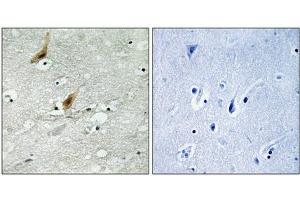 Immunohistochemistry analysis of paraffin-embedded human brain tissue using MSK2 (Phospho-Thr568) antibody. (MSK2 antibody  (pThr568))