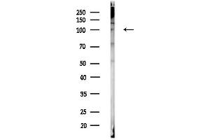 anti-Chloride Channel 2 (CLCN2) (C-Term) antibody