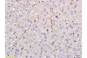Formalin-fixed and paraffin embedded rat liver tissue labeled with Anti-LEF-1 Polyclonal Antibody, Unconjugated at 1:200 followed by conjugation to the secondary antibody, (SP-0023), and DAB staining