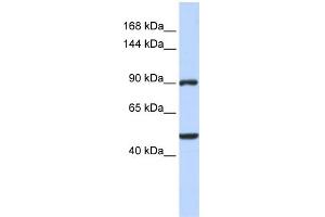 WB Suggested Anti-ZNF217 Antibody Titration:  0. (ZNF217 antibody  (Middle Region))