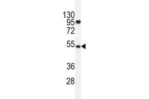 TdT antibody western blot analysis in K562 lysate. (TdT antibody  (AA 438-467))