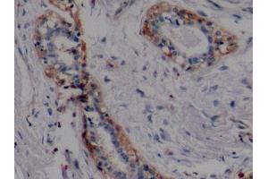 Immunohistochemistry (IHC) image for anti-Mucin 1 (MUC1) (AA 1098-1255) antibody (ABIN7429043)