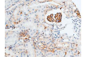 Immunohistochemistry (IHC) image for anti-Checkpoint Kinase 2 (CHEK2) (pThr387) antibody (ABIN6256554)