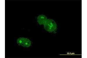Immunofluorescence of purified MaxPab antibody to ZNF32 on Hs 181. (ZNF32 antibody  (AA 1-273))