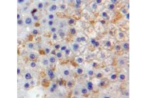Used in DAB staining on fromalin fixed paraffin-embedded Liver tissue (Selectin E/CD62e antibody  (AA 108-238))