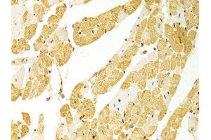 Immunohistochemistry of paraffin-embedded rat heart using PLCB1 antibody at dilution of 1:100 (x400 lens). (Phospholipase C beta 1 antibody)