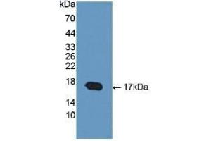 Detection of Recombinant COMP, Human using Polyclonal Antibody to Cartilage Oligomeric Matrix Protein (COMP) (COMP antibody  (AA 123-240))