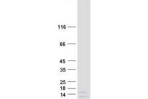 Validation with Western Blot