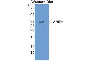 Western Blotting (WB) image for anti-Hepatitis A Virus Cellular Receptor 1 (HAVCR1) (AA 22-237) antibody (ABIN3207867) (HAVCR1 antibody  (AA 22-237))