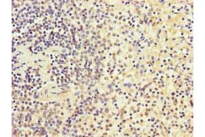 Immunohistochemistry of paraffin-embedded human spleen tissue using ABIN7168570 at dilution of 1:100 (SGF29 antibody  (AA 1-293))