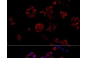 Immunofluorescence analysis of HeLa cells using CD40L Polyclonal Antibody at dilution of 1:100. (CD40 Ligand antibody)