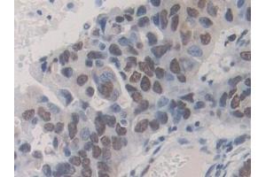 Immunohistochemistry (IHC) image for anti-Heterogeneous Nuclear Ribonucleoprotein A1 (HNRNPA1) (AA 2-372) antibody (ABIN7443554)