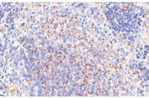 Immunohistochemistry of paraffin-embedded Rat spleen using PDGFR beta Polyclonal Antibody at dilution of 1:100 (40x lens). (PDGFRB antibody)