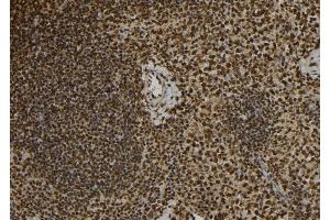 ABIN6277088 at 1/100 staining Mouse spleen tissue by IHC-P. (Progesterone Receptor antibody  (Internal Region))