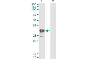 Western Blot analysis of CCS expression in transfected 293T cell line by CCS monoclonal antibody (M03), clone 1E2. (Superoxide dismutase copper chaperone antibody  (AA 175-274))