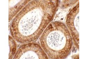 Immunohistochemistry (IHC) image for anti-Spermatogenesis Associated 6 (SPATA6) (C-Term) antibody (ABIN1077368)