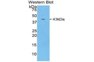 Western Blotting (WB) image for anti-Interleukin 12 Receptor, beta 2 (IL12RB2) (AA 559-647) antibody (ABIN3207281) (IL12RB2 antibody  (AA 559-647))