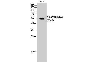 Western Blotting (WB) image for anti-CaMKIIalpha/beta/delta (pThr305) antibody (ABIN3172987) (CaMKIIalpha/beta/delta (pThr305) antibody)