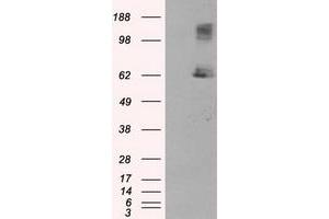 Image no. 5 for anti-Lipase, Endothelial (LIPG) antibody (ABIN1499166) (LIPG antibody)