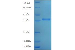 SDS-PAGE (SDS) image for Transporter 2, ATP-Binding Cassette, Sub-Family B (MDR/TAP) (TAP2) (AA 1-185), (full length) protein (His-SUMO Tag) (ABIN5711979)