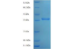 SDS-PAGE (SDS) image for Transporter 2, ATP-Binding Cassette, Sub-Family B (MDR/TAP) (TAP2) (AA 1-185), (full length) protein (His-SUMO Tag) (ABIN4975662) (TAP2 Protein (AA 1-185, full length) (His-SUMO Tag))