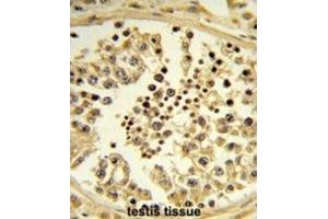 Immunohistochemistry (IHC) image for anti-Importin 11 (IPO11) antibody (ABIN3003903) (Importin 11 antibody)